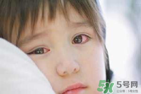 孩子為什么老眨眼睛？孩子總眨眼睛怎么回事？
