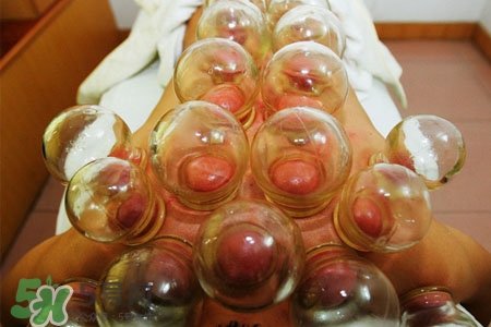 拔罐后皮膚發(fā)癢是怎么回事？拔罐后為什么皮膚會(huì)癢？