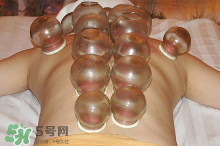 拔火罐后皮膚癢擦什么？拔火罐后皮膚癢怎么辦？