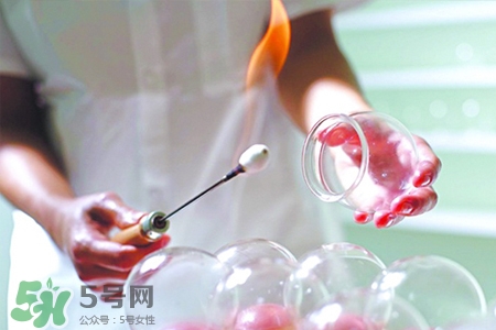 冬天拔罐后多久能洗澡？警惕冬季拔罐后不宜立即洗澡