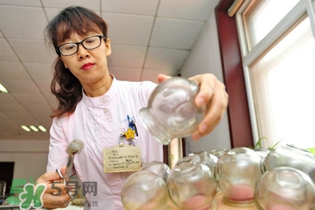針灸火罐后多久能洗澡？針灸火罐后能馬上洗澡嗎？