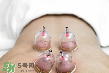 拔罐后可以喝酒嗎？拔罐后多久能喝酒？