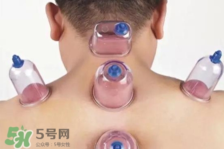 拔罐后可以喝酒嗎？拔罐后多久能喝酒？