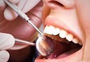 拔牙之后可以吃藥嗎？拔牙之后要不要吃藥？