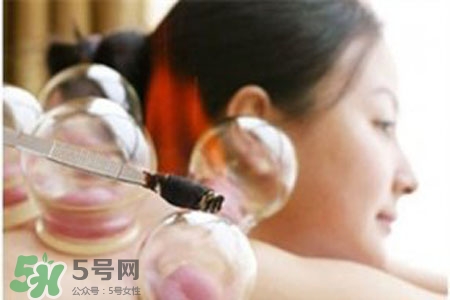 冬天拔火罐能減肥嗎？拔火罐什么季節(jié)減肥效果最好？