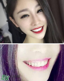 碧緹福冷光牙齒美白儀怎么用？碧緹福冷光牙齒美白儀使用方法