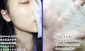 稚優(yōu)泉面膜怎么用？稚優(yōu)泉面膜要洗嗎？