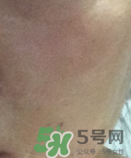 skin1004是什么牌子？skin1004屬于什么檔次