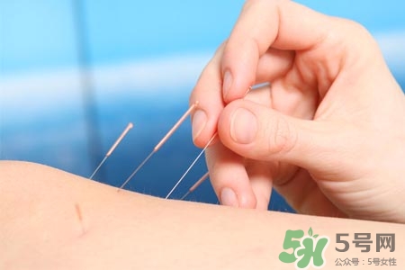 腰間盤突出可以針灸嗎？針灸能治腰間盤突出嗎？