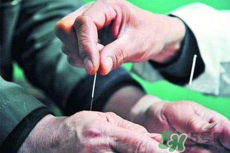 腰間盤突出可以針灸嗎？針灸能治腰間盤突出嗎？
