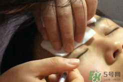 埋線雙眼皮需要拆線嗎？埋線雙眼皮怎么拆線