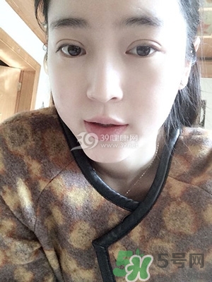 什么是定點雙眼皮？定點雙眼皮多少錢？