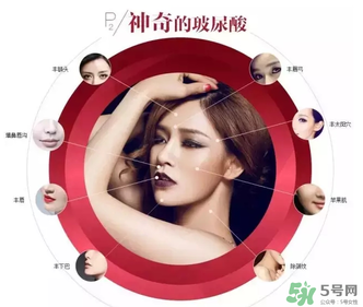 喬雅登是哪個(gè)國(guó)家的？喬雅登玻尿酸哪個(gè)國(guó)家？