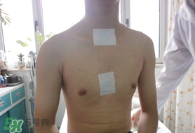 三九貼怎么貼？三九貼的貼法