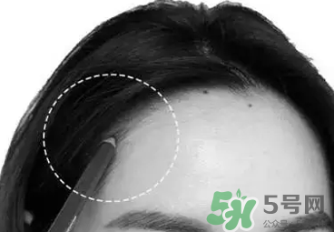發(fā)際線高適合什么發(fā)型？發(fā)際線高怎么辦