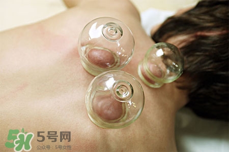 拔罐放血會得傳染病么？拔罐放血會傳染疾病嗎？