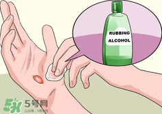 水泡怎么處理？水泡要不要刺破？