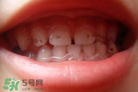 刷牙后吃東西發(fā)苦正常嗎？為什么刷牙后吃東西發(fā)苦？