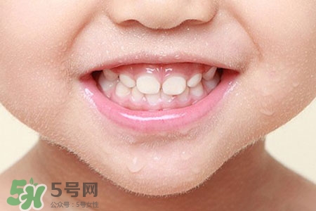 刷牙后吃東西發(fā)苦正常嗎？為什么刷牙后吃東西發(fā)苦？