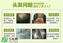 牛角梳梳頭可以生發(fā)嗎？牛角梳怎么梳頭？