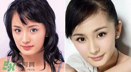 打瘦臉針能懷孕嗎？打瘦臉針能吃避孕藥嗎？