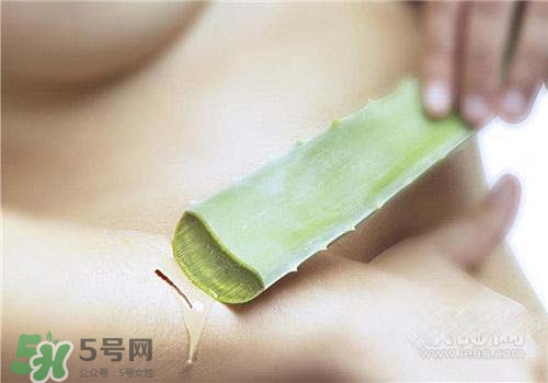 蘆薈涂在臉上發(fā)癢是怎么回事？蘆薈涂在臉上發(fā)癢怎么辦？