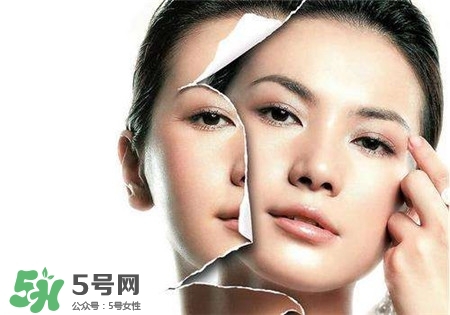 美白針是什么？美白針可以連續(xù)打嗎？