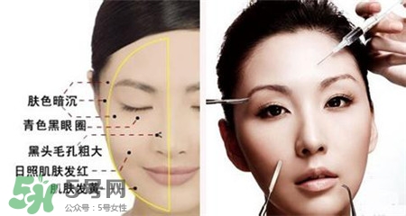 美白針的效果明顯嗎？美白針一個療程幾次？