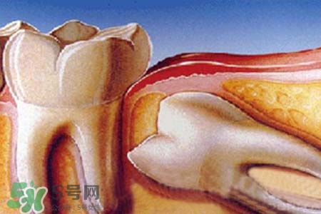 智齒會一直長嗎？智齒會停止生長嗎？