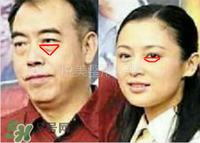 臥蠶是黑眼圈嗎？臥蠶和黑眼圈的區(qū)別