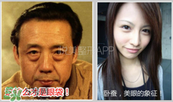 臥蠶是黑眼圈嗎？臥蠶和黑眼圈的區(qū)別