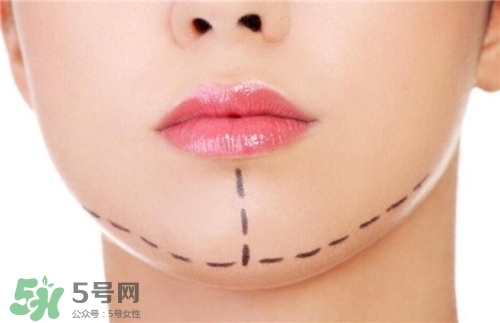 玻尿酸墊下巴能維持多久？玻尿酸墊下巴能維持多長(zhǎng)時(shí)間？
