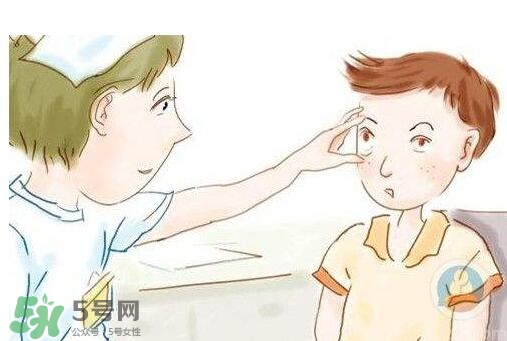 紅眼病用什么眼藥水好？紅眼病吃什么好得快