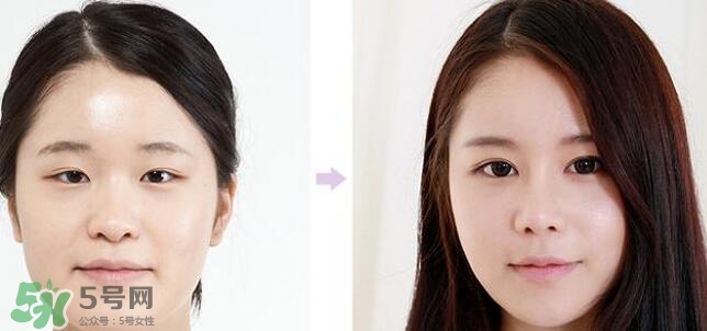 哪些人需要開(kāi)眼角？需要開(kāi)眼角的眼睛圖片