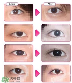 哪些人需要開(kāi)眼角？需要開(kāi)眼角的眼睛圖片