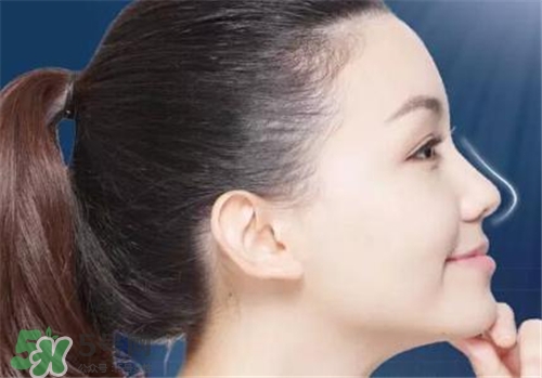 隆鼻會(huì)拉近眼距嗎？隆鼻會(huì)改變眼睛嗎？
