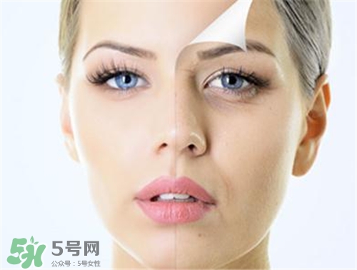 玻尿酸除皺有效果嗎？玻尿酸除皺效果怎么樣？