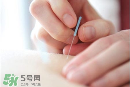 沒病可以針灸嗎？沒病可以扎針嗎？