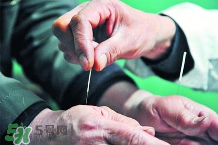 沒病可以針灸嗎？沒病可以扎針嗎？