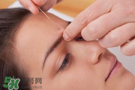 沒病可以針灸嗎？沒病可以扎針嗎？