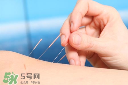沒病可以針灸嗎？沒病可以扎針嗎？