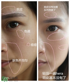 赫拉氣墊用了悶痘嗎？赫拉氣墊悶痘怎么辦？