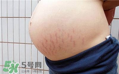 妊娠紋幾個(gè)月開始出現(xiàn)？妊娠紋能消除掉嗎？