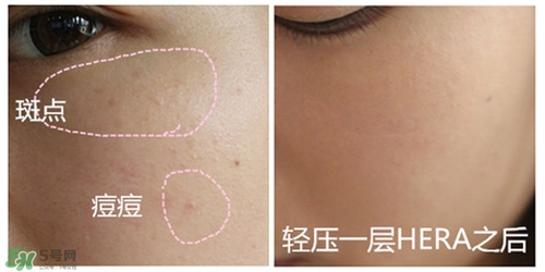 赫拉氣墊用了悶痘嗎？赫拉氣墊悶痘怎么辦？