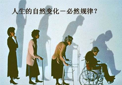 哪些人容易得骨質(zhì)疏松癥？骨質(zhì)疏松的高發(fā)人群有哪些？