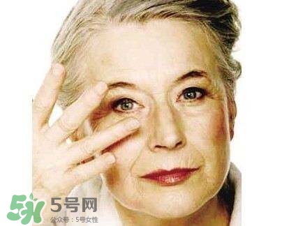 老年斑是怎么形成的？老年斑的形成原因
