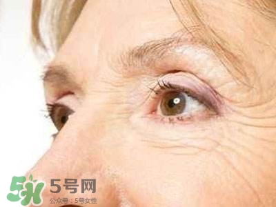 老年斑是怎么形成的？老年斑的形成原因