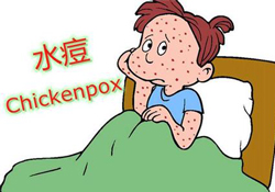 水痘是天花嗎？水痘是不是天花？