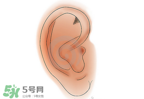 中耳炎有什么癥狀？中耳炎的癥狀表現(xiàn)