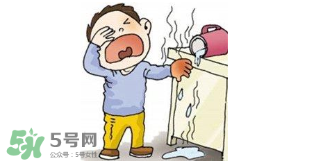 燙傷可以用牙膏嗎？燙傷用牙膏管用嗎？